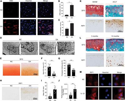 RIP1 Perturbation Induces Chondrocyte Necroptosis and Promotes Osteoarthritis Pathogenesis via Targeting BMP7